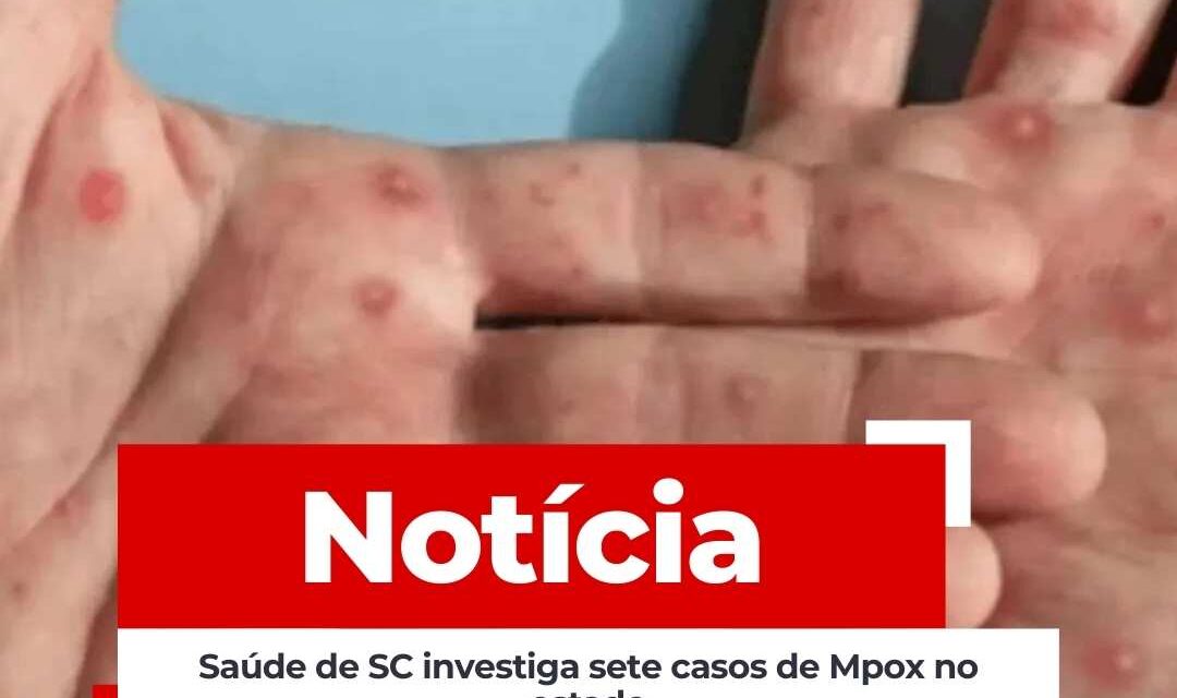 Saúde de SC investiga sete casos de Mpox no estado