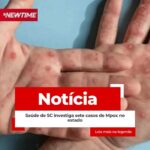 Saúde de SC investiga sete casos de Mpox no estado