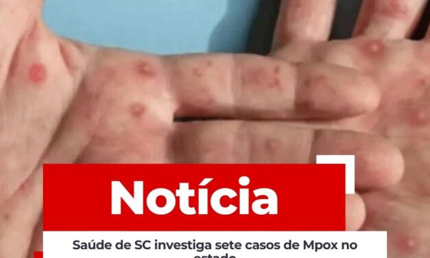 Saúde de SC investiga sete casos de Mpox no estado